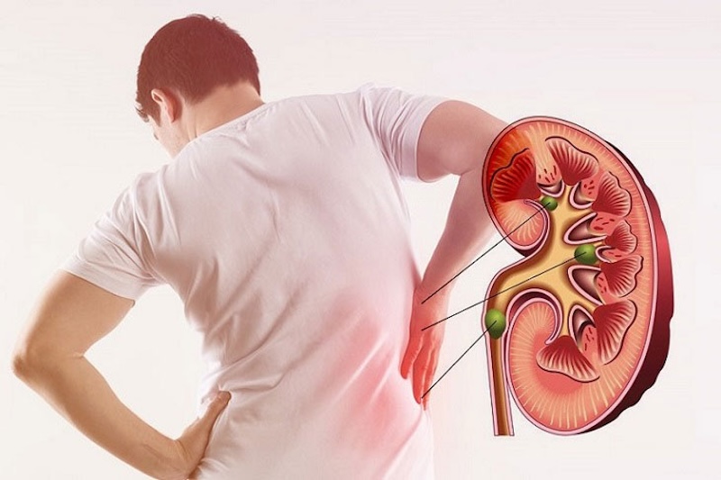 Bị suy thận ăn rau má được không bi suy than an rau ma duoc khong