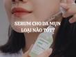 Serum cho da mụn loại nào tốt? Tiêu chí lựa chọn và gợi ý sản phẩm hiệu quả